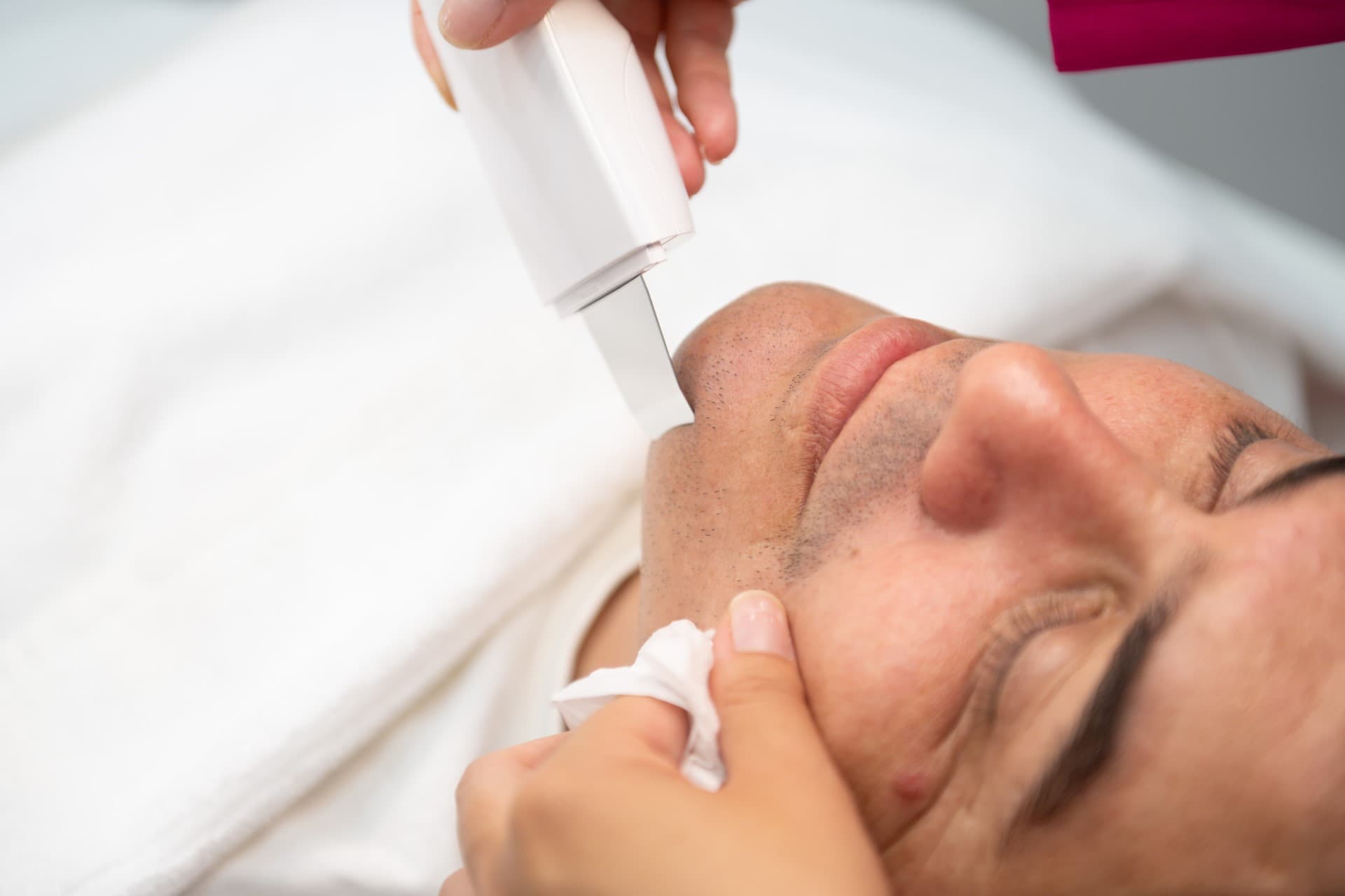 limpieza facial en Vigo